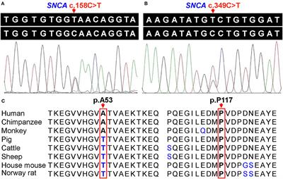 Genetic Analysis and Literature Review of SNCA Variants in Parkinson's Disease